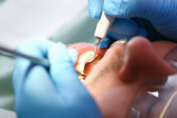 Best Emergency Gum Treatment in Grandview, IL