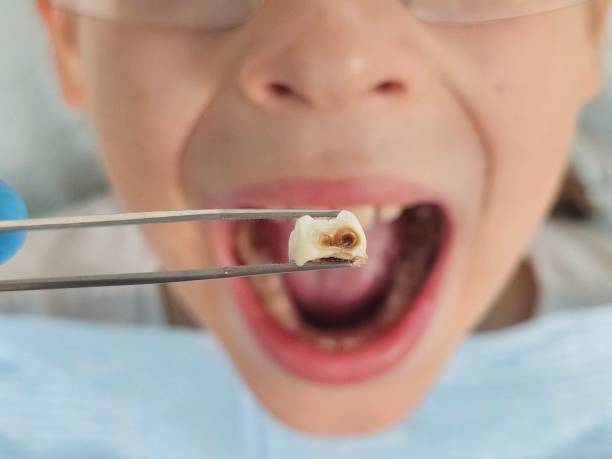 Best Pediatric Emergency Dentist in Grandview, IL