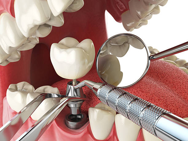 Best Cosmetic Emergency Dentistry in Grandview, IL